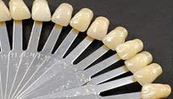 Dental Bonding in Amherst & Williamsville Bonding is a popular method of cosmetic dentistry to enhance the aesthetics of your smile. Bonding can be used to correct cracks or gaps in teeth, as a filling after a cavity has been removed, or to cover up stains or discolored teeth. A composite resin is used on the affected tooth or teeth. It is molded and sculpted over an adhesive gel that is placed on the tooth. After the resin has been applied an ultraviolet light is used to harden the resin, which is then polished to give you a fresh, new smile. Bonding is an obvious improvement over unsightly silver amalgam fillings. With the advancements in dental technology, bonding usually lasts for over 10 years. It is a safe, affordable, and attractive cosmetic dentistry solution for many dental problems. We all have different shades of teeth. We match your new resin material to your tooth color, making it look seamless.