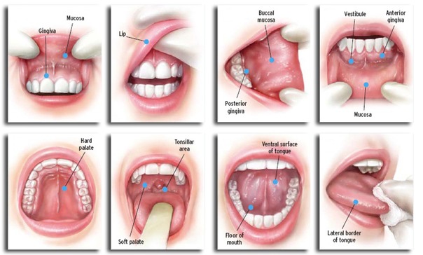 Oral Cancer - How to spot Signs and Symptoms 
